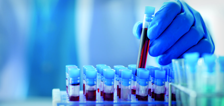 University of Tokyo Develops AI-Powered Blood Test Using Just a Standard Microscope